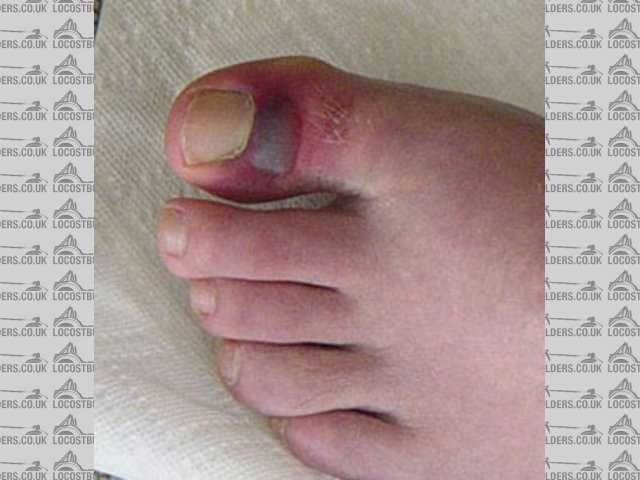 Rescued attachment Big toe s.jpg